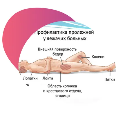 Пролежни: больно, опасно, необходимо лечить — Старость в радость