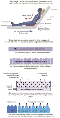 Почему появляются пролежни?