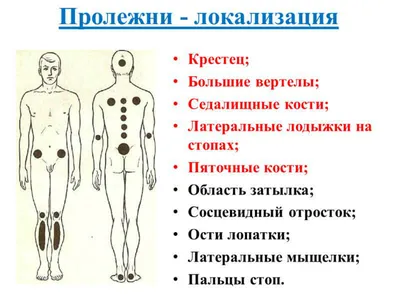 Как лечить пролежни в домашних условиях? | медицинские товары и медтехника  в магазине Ортосалон