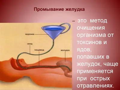 Тренажер для зондирования и промывания желудка (67х23х29 см)