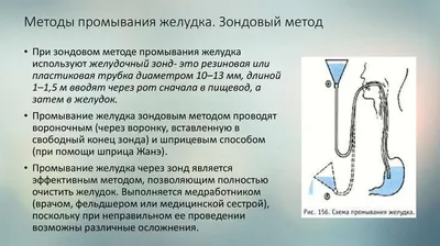 Манекен для отработки навыков промывания желудка (раздел «Сестринское  дело») | Купить учебное оборудование по доступным ценам в ПО «Зарница»