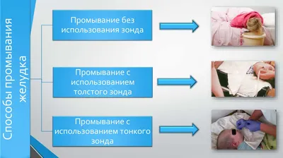 Процедура - сифонное промывание кишечника минеральной водой в санатории им.  М.И. Калинина Минздрава России, комментарии