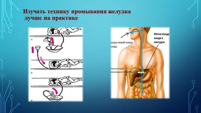 Содержание 1. Проведение промывания желудка с помощью зонда (на фантом