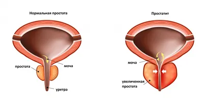 Собаки-ищейки могут обнаружить рак простаты по запаху ➤ статьи Oncogenotest