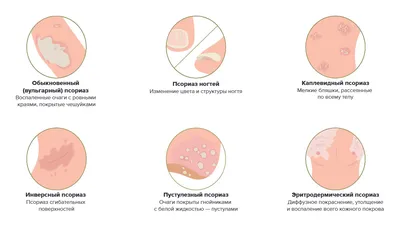 Psoriaz.life