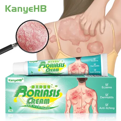 Кожное заболевание собаки Брауна Стоковое Изображение - изображение  насчитывающей цемент, собач: 133092691