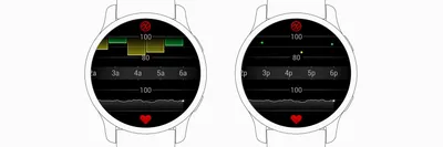 A Finger on the Pulse or An Ultrasound Probe on the Pulse? — Taming the SRU