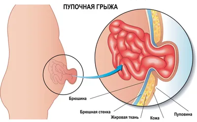 Пуповина новорожденного щенка/котенка, норма и что должно насторожить |  ЗооЯсли | Дзен