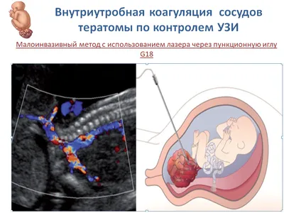 Развитие плода по неделям беременности: вес, рост, расположение, этапы