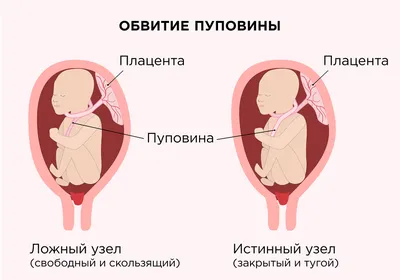 Беременность по неделям | Клиника ведения беременности в Пятигорске