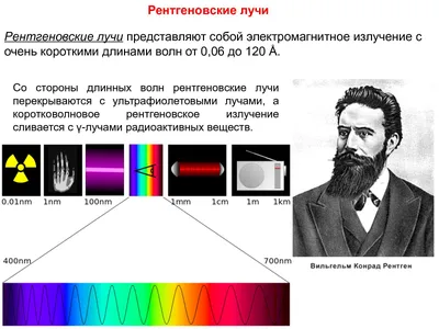 8 ноября 1895 года, 125 лет назад, физик Вильгельм Рентген открыл «рентгеновские  лучи» | Пикабу