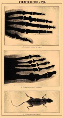 Рентгеновские лучи в медицине и технике | ⚠️ Инженерные знания | Дзен