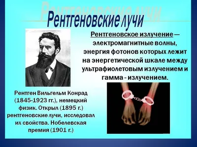 Почему 125 лет назад рентгеновские лучи были развлечением, а потом изменили  мир / AdMe