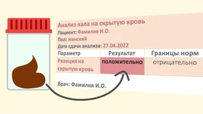 Р-РЕЗУЛЬТАТ Отличный результат подопечного, всего за 3 месяца тренировок, с  нашим тренером Белик Анатолием!.. | ВКонтакте