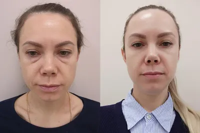 Чавдаров Самир Руменович, пластический хирург - отзывы, цены - Воронеж