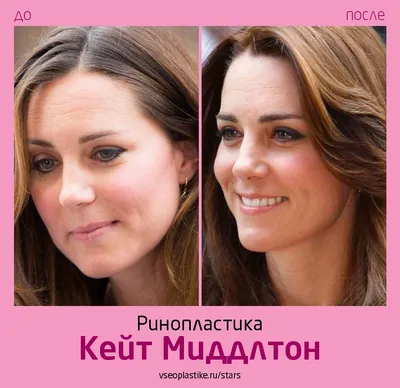 Пластический хирург Сутулов | Воронеж, Липецк (@dr.sutulov) • Instagram  photos and videos