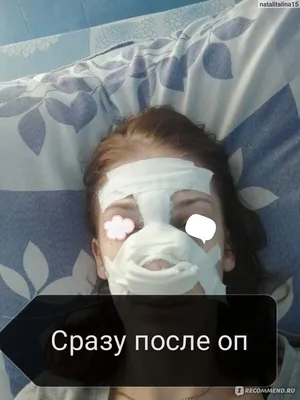 Ринопластика и септопластика в Smart Clinic по акционной цене от 260 000  рублей!