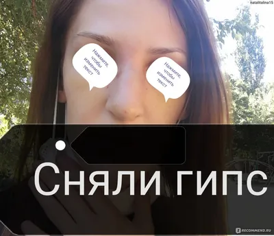 Кейт Миддлтон до и после ринопластики