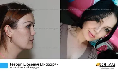 Пластическая хирургия Воронеж | Ардамед | ВКонтакте