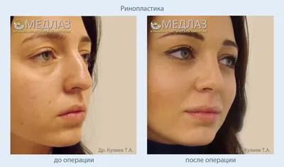 Пластическая хирургия в медицинском центре в Воронеже: услуги пластики по  доступным ценам, записаться на консультацию и операцию к хирургу в клинике  Пересвет