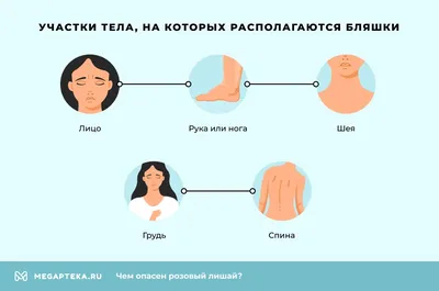 Лишай розовый у человека или питириаз розовый Жибера