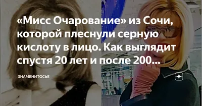 Как живёт сейчас модель Элеонора Кондратюк, облитая кислотой 20 лет назад |  ЗВЕЗДОЛЁТ | Дзен