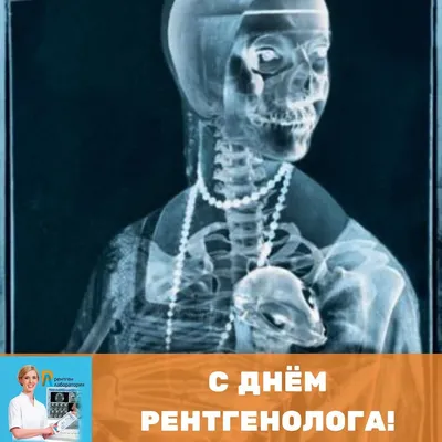 С ДНЕМ РЕНТГЕНОЛОГА!