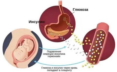 Инсулинозависимый сахарный диабет первого типа: лечение и диагностика в  Москве