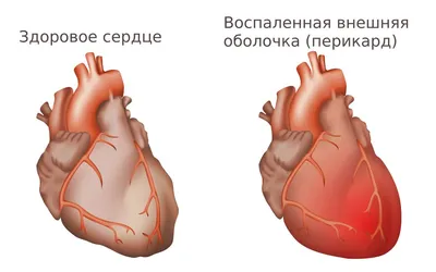 Сердце иллюстрации вектора собаки Иллюстрация вектора - иллюстрации  насчитывающей медицинско, сердце: 61167107