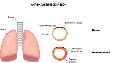 Картинки на тему #шок - в Шедевруме