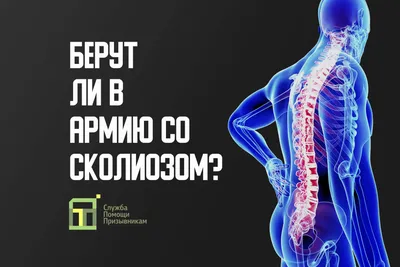 Сколиоз 3 степени. Лечение искривления позвоночника в СПб