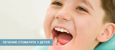 Стоматит у ребенка: лечение, допустимые препараты, симптомы, признаки,  профилактика в домашних условиях