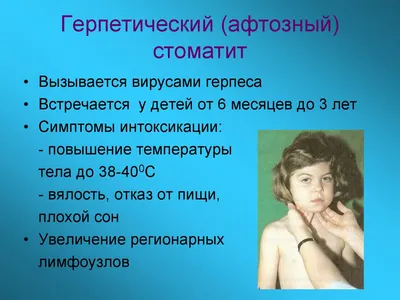 Как лечить стоматит у детей — блог медицинского центра ОН Клиник