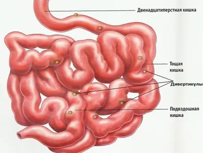 Анатомия человека: Брюшина, peritoneum. Полость брюшины. Брюшная полость