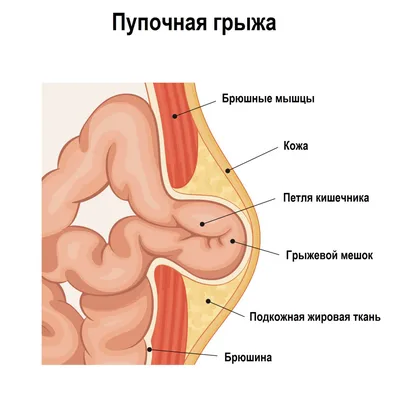 Брыжейка: структура, функции и её роль в развитии заболеваний