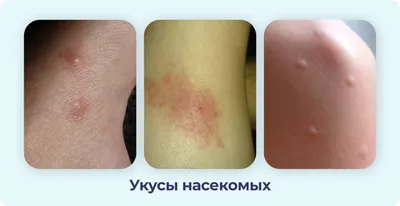 Гипотиреоз у собак - симптомы, лечение