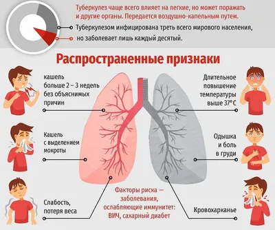 Фтизиатр: Туберкулез влияет на сердце и сосудыForPost - Здоровье |