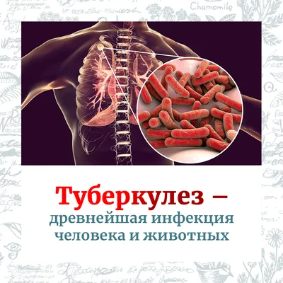 Туберкулез заразен и опасен — ГБУЗ СО Дегтярская Городская Больница