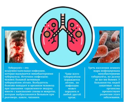 Туберкулез. Что это такое? | ГУЗ \"Ононская центральная районная больница\"