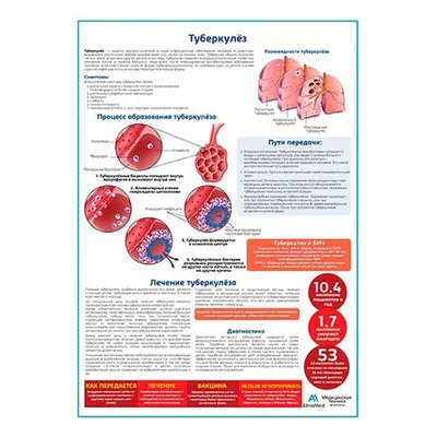 Осторожно, туберкулез