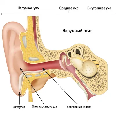 Пластика мочки уха: показания и результат