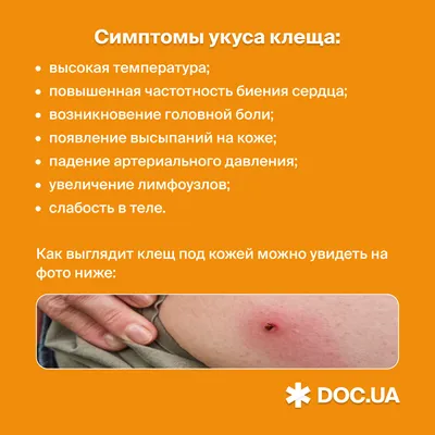 Постельные клопы - Доказательная медицина для всех