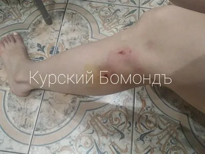 В Беларуси отмечены случаи заболевания, при котором под кожей собак или  человека развивается опасный паразит - KP.RU