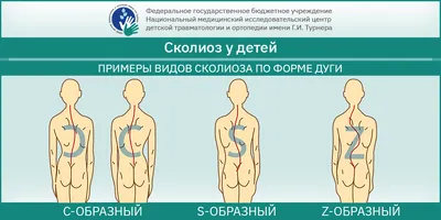 Физиотерапевтические упражнения при сколиозе - полный обзор семи основных  школ| Новости |Международная ассоциация мануальной терапии др. Типальдоса -  FDM Ukraine