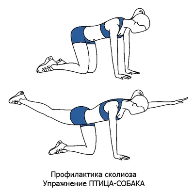 S-образный сколиоз: причины, диагностика, лечение