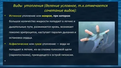 Понятие \"утопление\" в судебной медицине – тема научной статьи по прочим  медицинским наукам читайте бесплатно текст научно-исследовательской работы  в электронной библиотеке КиберЛенинка