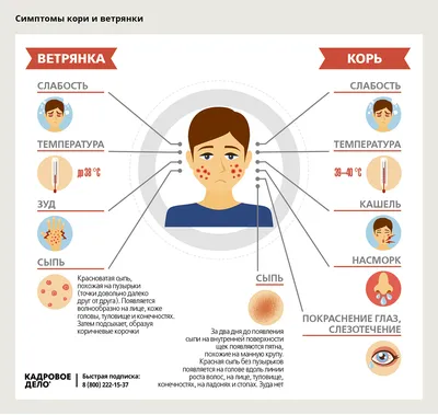 Ветрянка. Заболеть или привиться? – Семейная клиника «Доктор АННА»