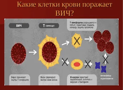 Что такое ВИЧ-инфекция?