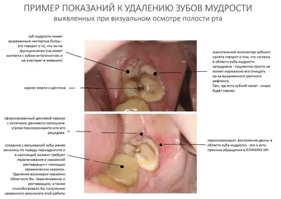 Иллюстрация 4 из 21 для Одонтогенные воспалительные заболевания полости рта.  Учебное пособие - Базикян, Бычков, Гончаров | Лабиринт - книги. Источник:  Лабиринт