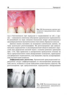 Иллюстрация 8 из 21 для Одонтогенные воспалительные заболевания полости рта.  Учебное пособие - Базикян, Бычков, Гончаров | Лабиринт - книги. Источник:  Лабиринт